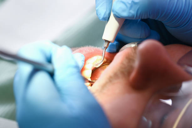Best 24-Hour Emergency Dental Care in Listoga, CA